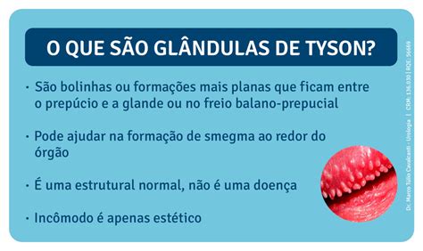 glandulas tyson o que é|Glândulas de Tyson: o que são e veja se é preciso tratá